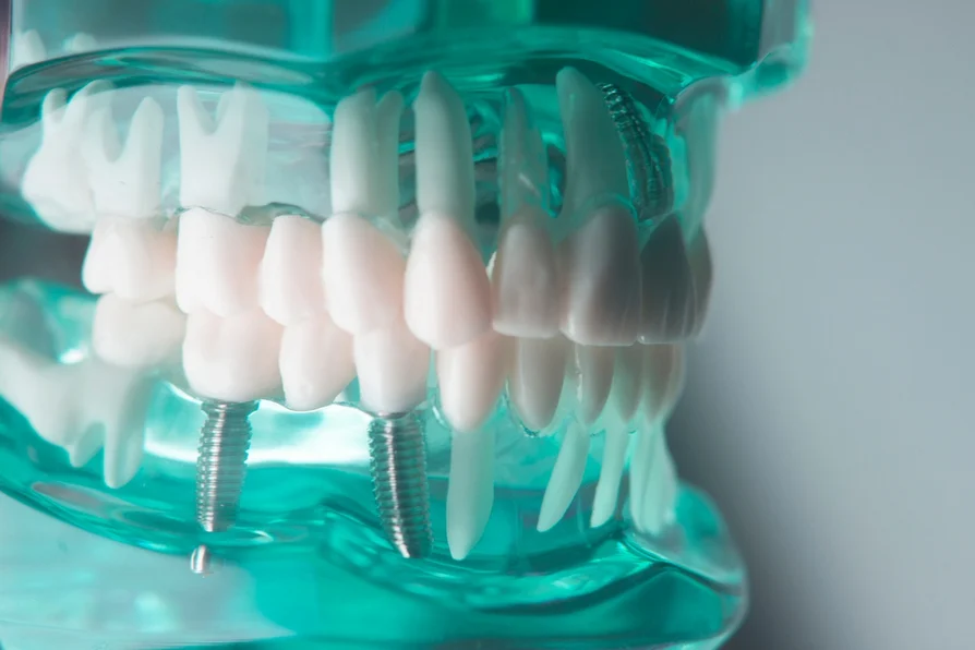 dental implant courses
